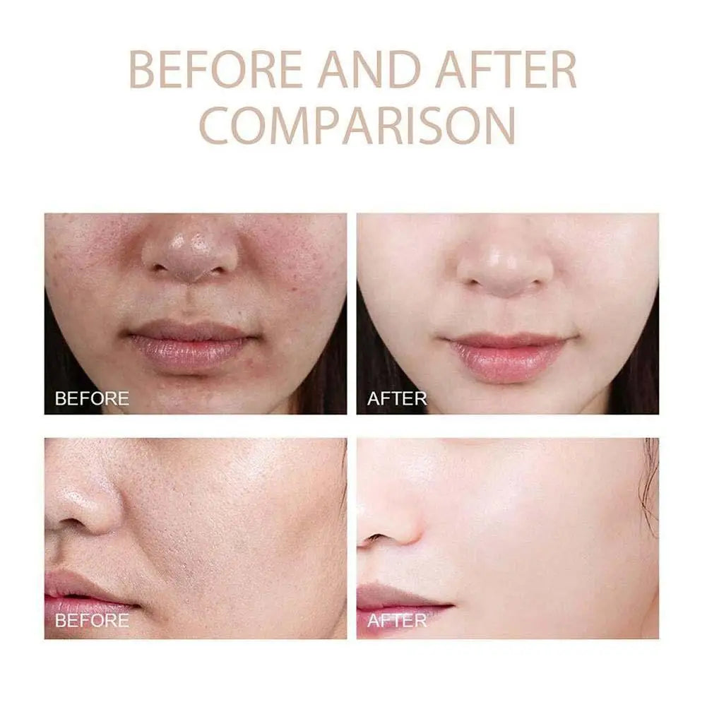 EveryBox Glow Rice Peel™